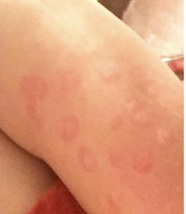 IF your skin looks like this