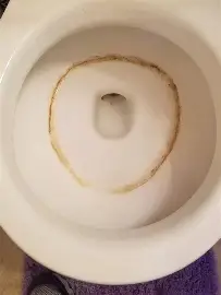 IF your toilet looks like this