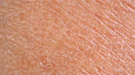 IF your skin looks like this